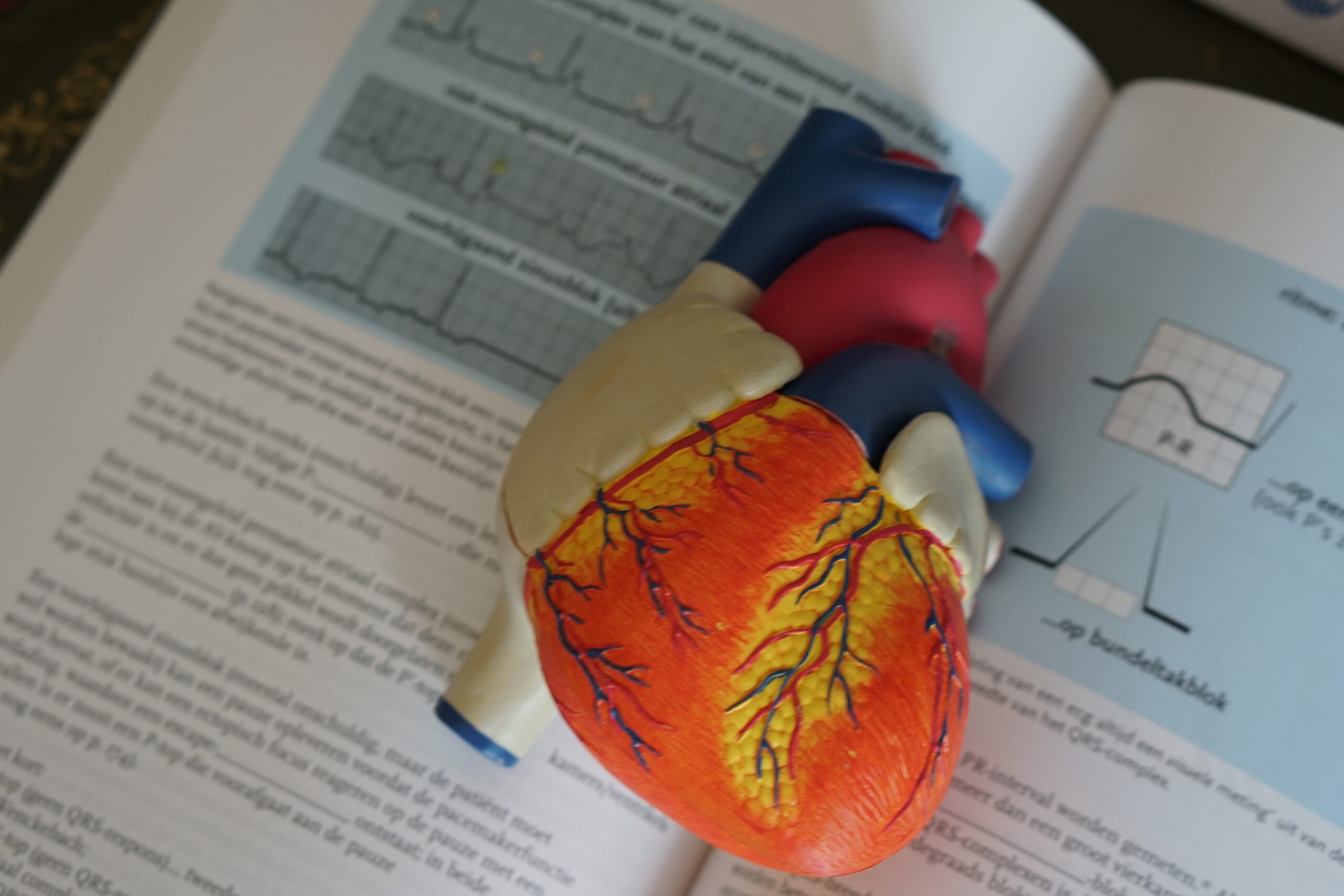 You are currently viewing Nitroglycerin in Prehospital Chest Pain Management: Debunking Myths and Understanding its Impact