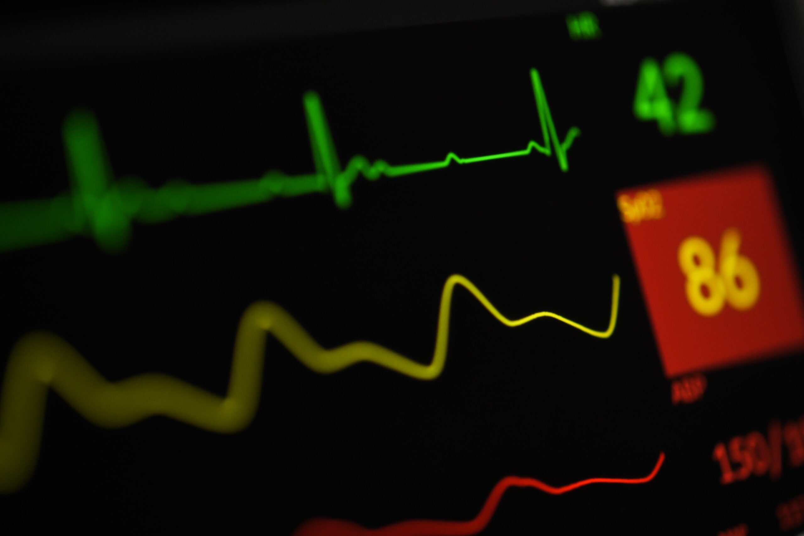 You are currently viewing Navigating Critical Care: Unveiling the Differences Between Pressors and Inotropes