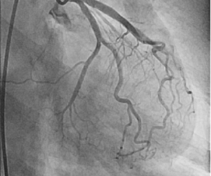 Read more about the article Safe Transfer of Patients with Suspected Myocardial Infarction to Facilities with Cath Labs