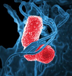 Read more about the article Hospital-Acquired Pneumonia (HAP): Understanding, Complications, and Prevention