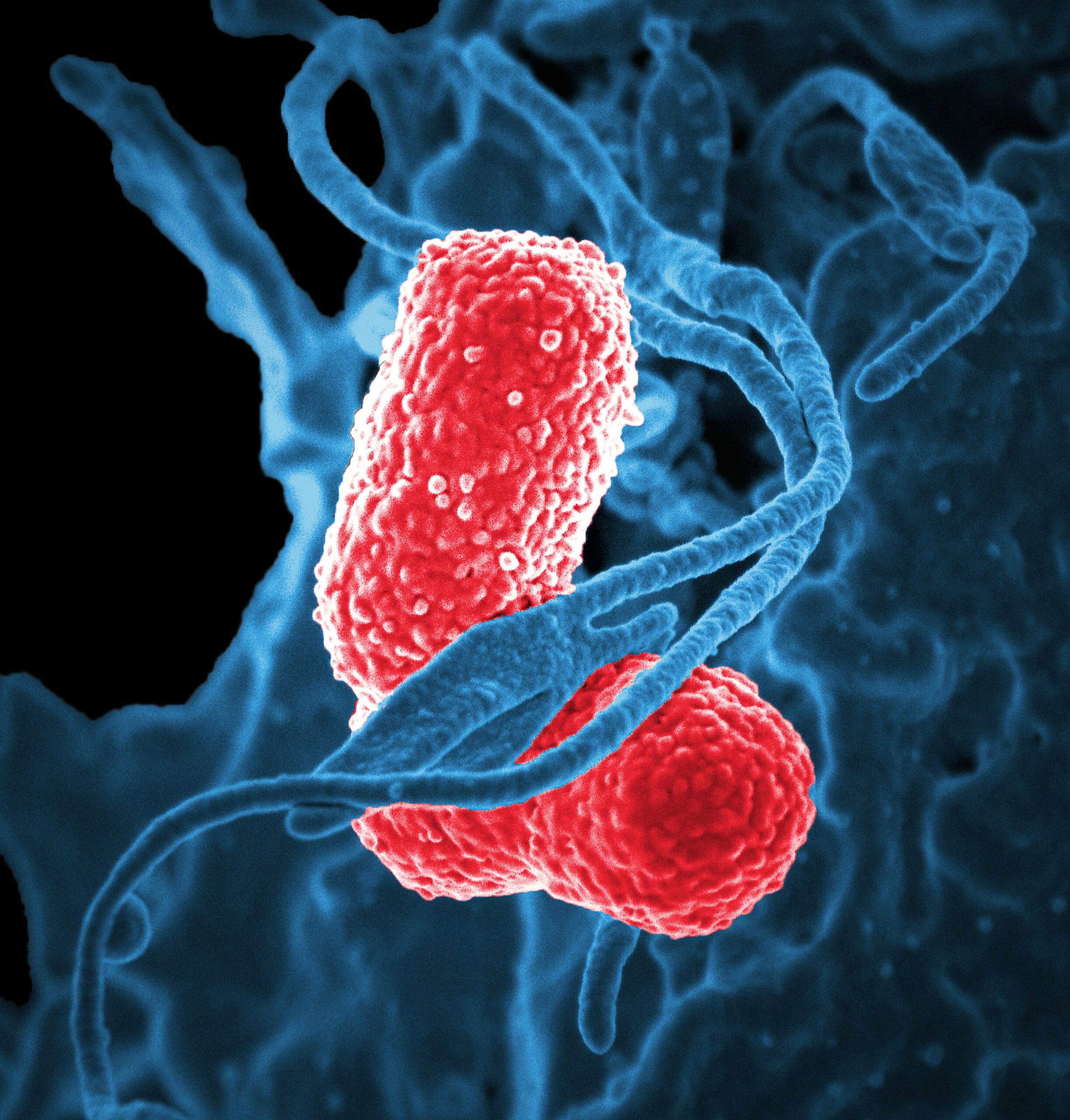 Read more about the article Hospital-Acquired Pneumonia (HAP): Understanding, Complications, and Prevention