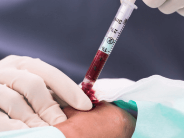 Read more about the article Hypoxia or Hypercarbia: Why ABGs Are Crucial for Ventilator Management