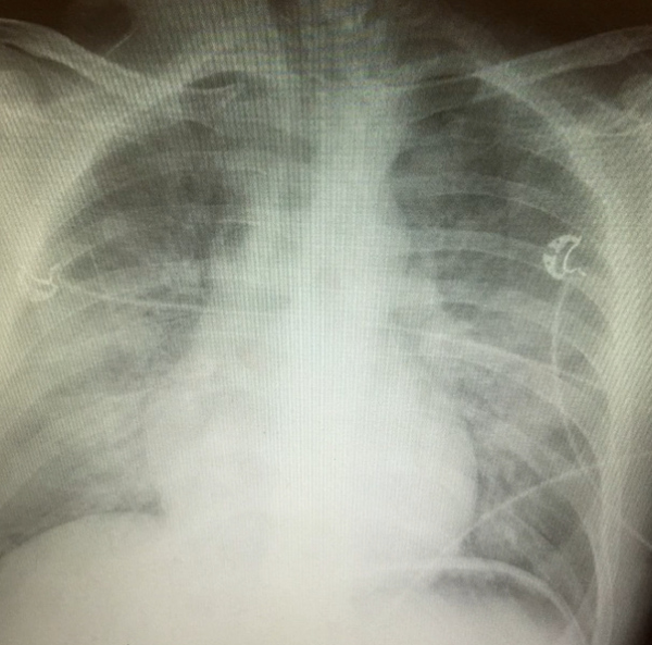 ARDS: From Recognition to Recovery A Comprehensive Clinical Guide – AGC MED